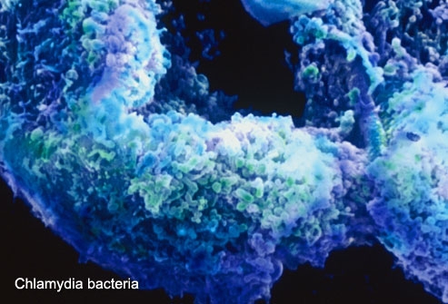 Bestie Virus Chlamydia