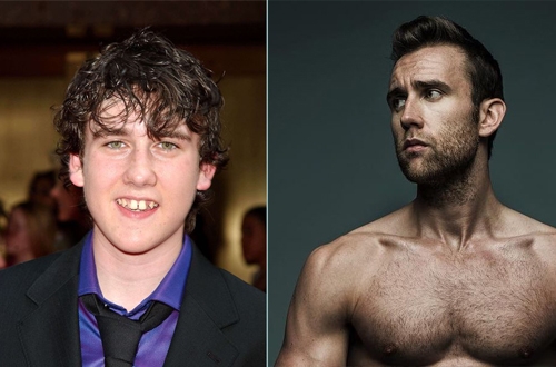 Bestie Matthew Lewis