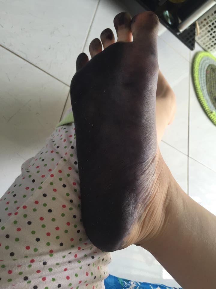 Bestie dap thuoc tri tai bien 2