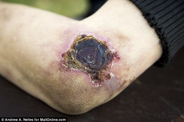 Bestie ma tuy krokodil 11