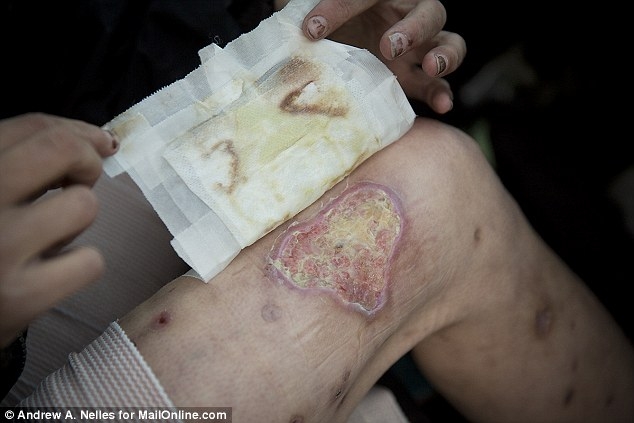 Bestie ma tuy krokodil 10