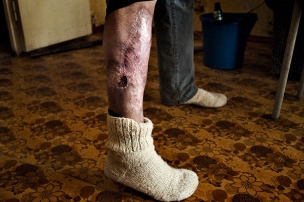 Bestie ma tuy krokodil 7