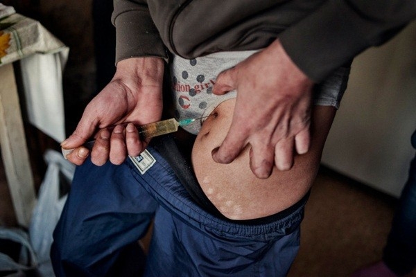 Bestie ma tuy krokodil 1