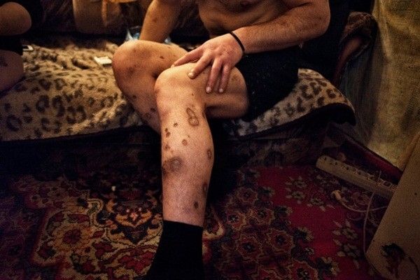 Bestie ma tuy krokodil 9