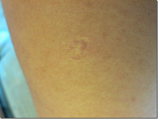 Bestie vaccine dau mua