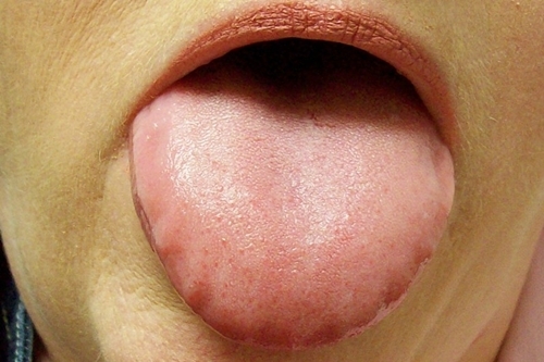 Một ngày của bạn sẽ u ám như mây đen nếu thiếu hụt loại vitamin này