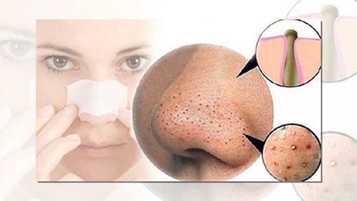 Chăm chỉ làm 6 điều này trước khi ngủ bạn sẽ xinh đẹp hơn rất nhiều