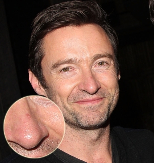 Bestie hugh jackman