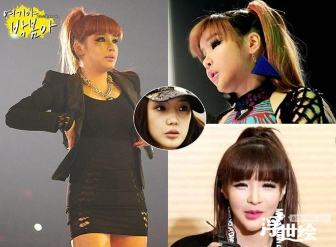 Lạm dụng bơm căng mặt, Park Bom trở thành “sản phẩm lỗi” của phẫu thuật thẩm mỹ.