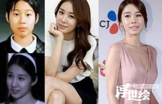 Gương mặt Yoo In Na ngày một cứng đờ, vô cảm vì lạm dụng filler.