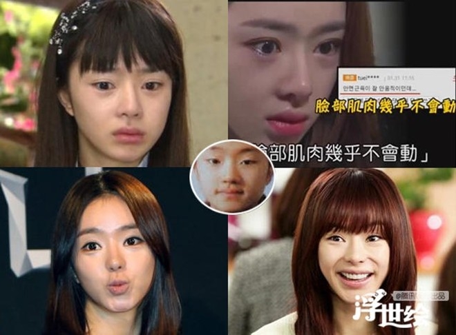 Gương mặt phù nề của Seo Woo khiến nhiều người không thoải mái khi nhìn.