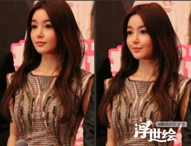 “Búp bê Hàn Quốc” Nam Gyu Ri ngày càng biến dạng vì lạm dụng botox.