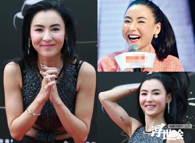 Đẹp nghiêng nước nghiêng thành như Trương Bá Chi cũng không thể chống lại thời gian. Cô đã chọn tiêm chất làm căng mặt để xóa đi các giấu hiệu của lão hóa.