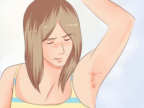 5 chứng bệnh thường xuất hiện nhất ở tuổi dậy thì