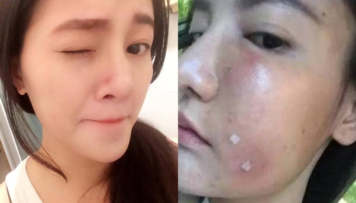 Bestie tiem trang da
