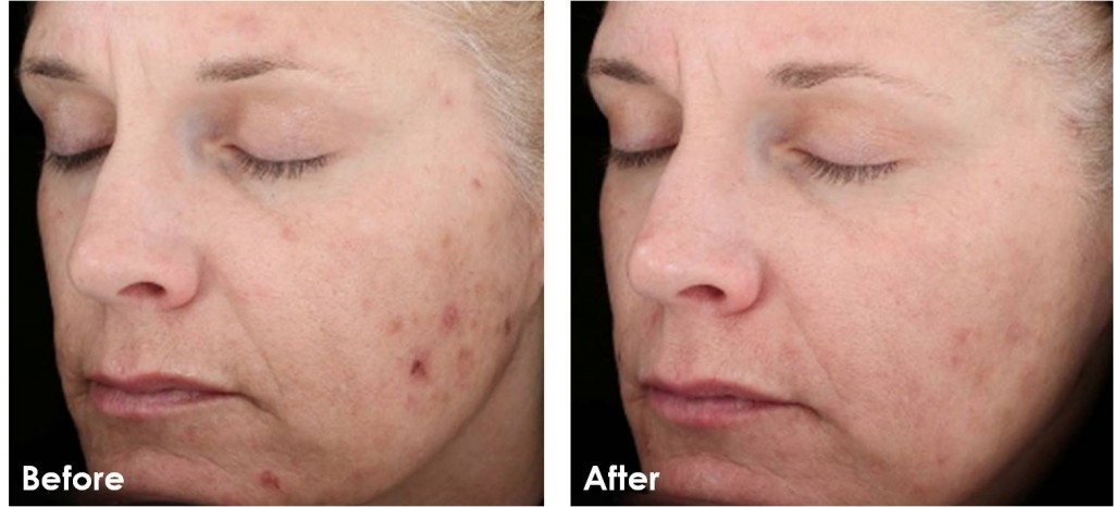 bestie-retinol-va-cach-su-dung