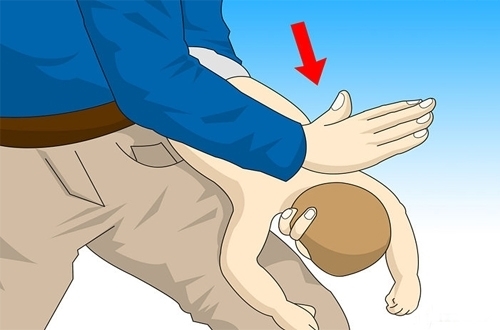 Bestie CPR