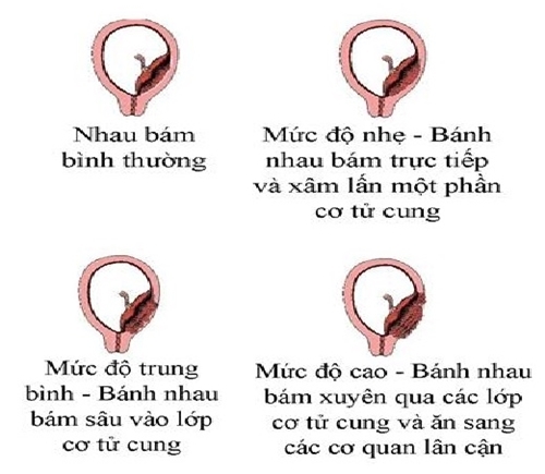 Bestie nhau cai rang luoc