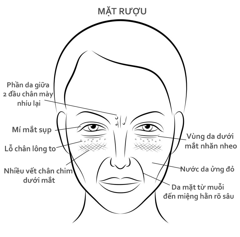 Bestie mat ruou