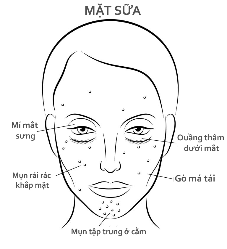 Bestie mat sua 2