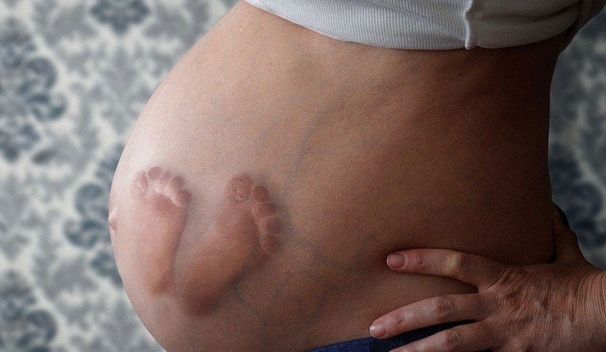 6 dấu hiệu nguy hiểm khi thai nhi không phát triển mà mẹ bầu nên biết