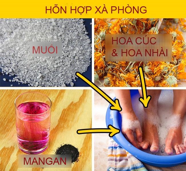 bestie chua vet chai chan phong rop