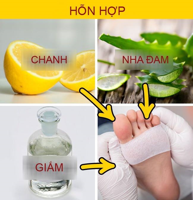 bestie chua vet chai chan phong rop