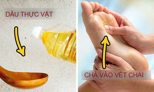 bestie chua vet chai chan phong rop
