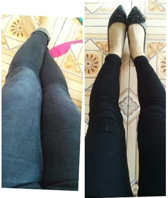 bestie lot xac sau sinh