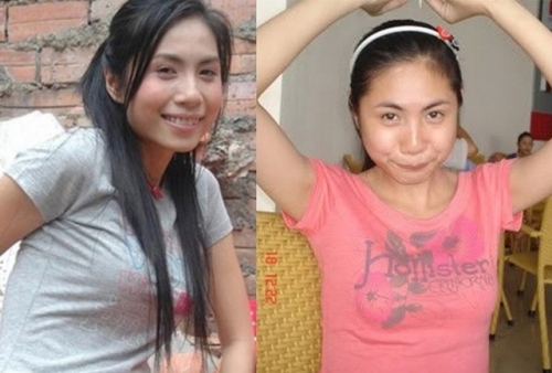 bestie sao Viet - Han thanh cong sau phau thuat tham my