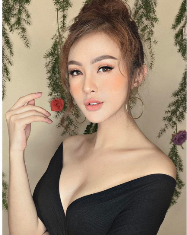 bestie sao viet phau thuat tham mi