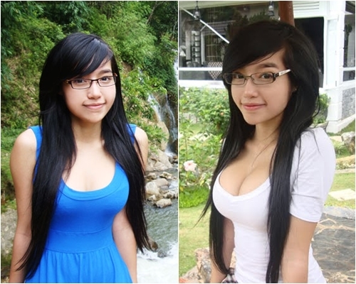 bestie sao viet phau thuat tham mi