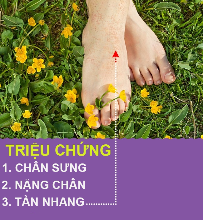 9 dấu hiệu qua chân cho biết cơ thể bạn có vấn đề về sức khỏe