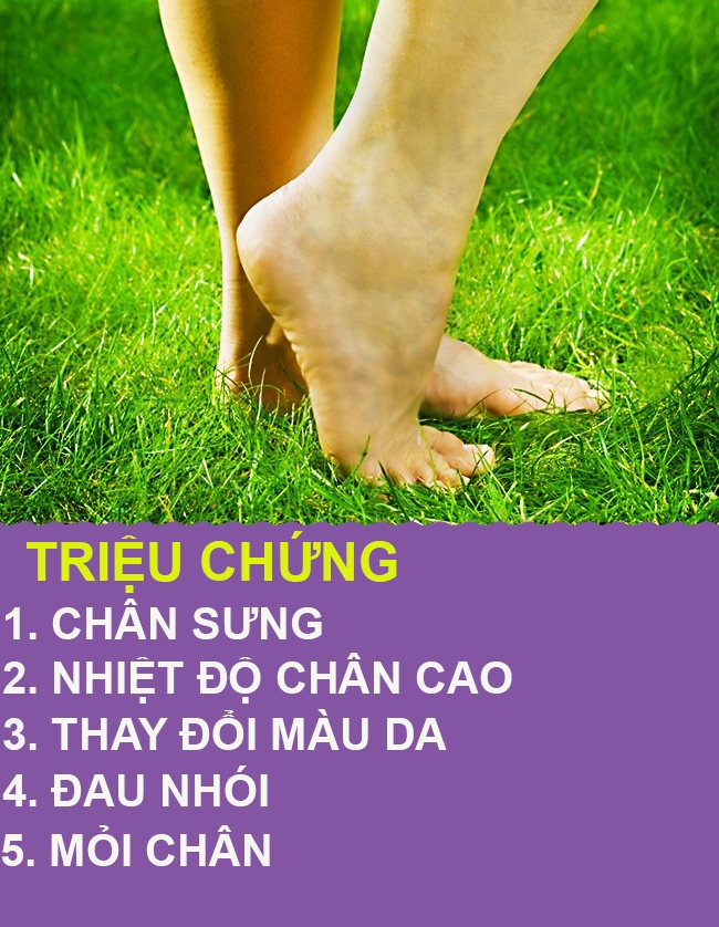 9 dấu hiệu qua chân cho biết cơ thể bạn có vấn đề về sức khỏe