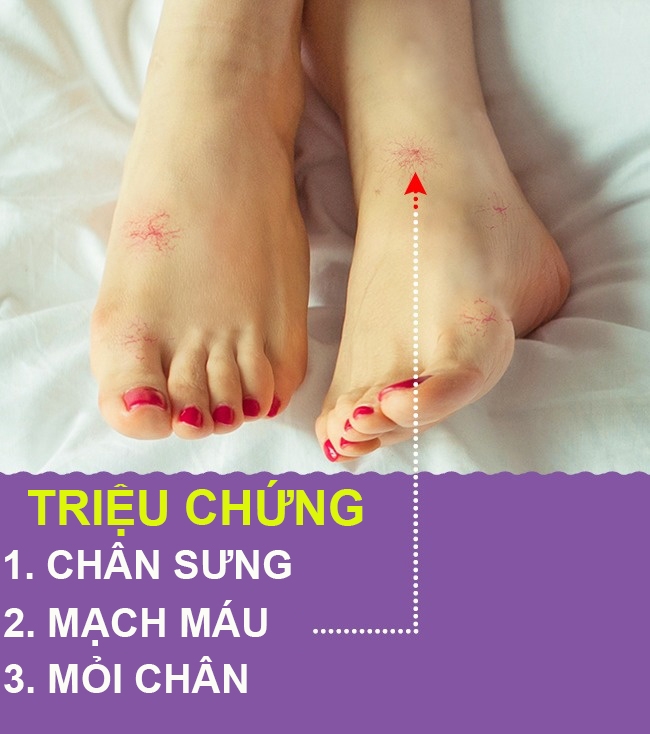 9 dấu hiệu qua chân cho biết cơ thể bạn có vấn đề về sức khỏe