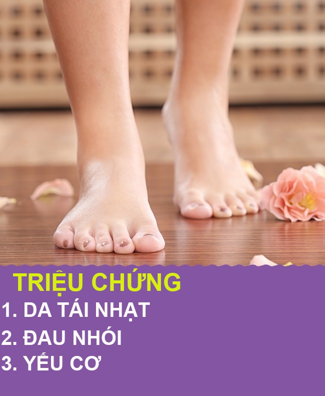 9 dấu hiệu qua chân cho biết cơ thể bạn có vấn đề về sức khỏe