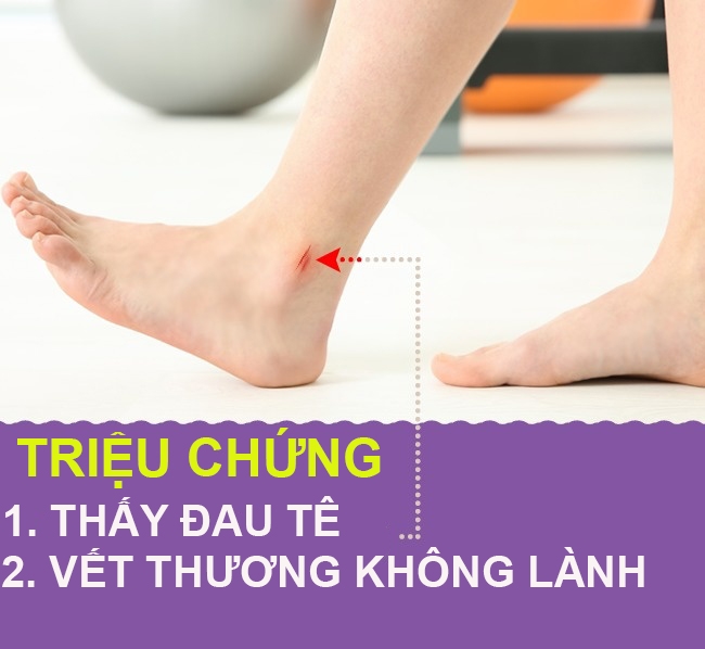 9 dấu hiệu qua chân cho biết cơ thể bạn có vấn đề về sức khỏe
