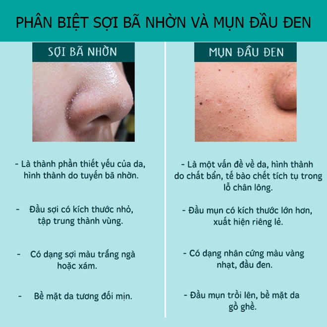 bestie phân biệt sợi bã nhờn và mụn đầu đen 4