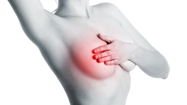 Các dấu hiệu cảnh báo sớm bệnh ung thư vú phụ nữ cần phải biết