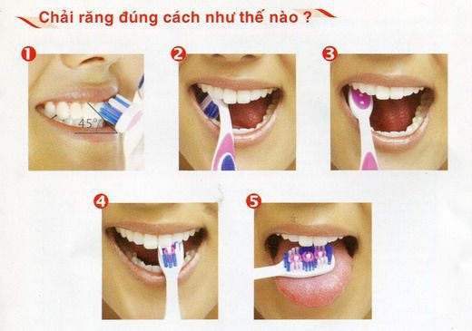 Sai lầm khi đánh răng mà ai cũng mắc phải