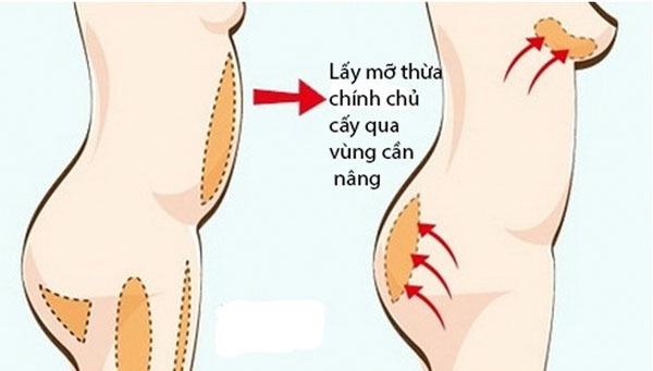 bestie 10 dieu can biet truoc khi nang nguc 7