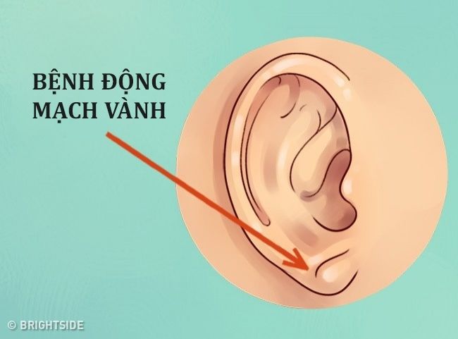 bestie nhung dau hieu o tai giup chan doan benh