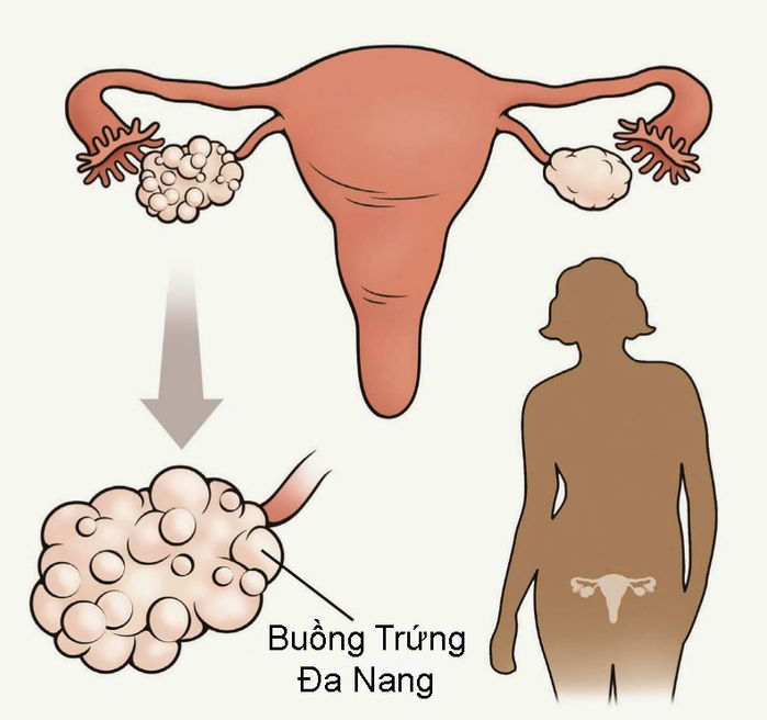 bestie buong trung da nang