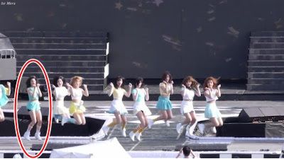 bestie idol nu mac benh ngoi sao