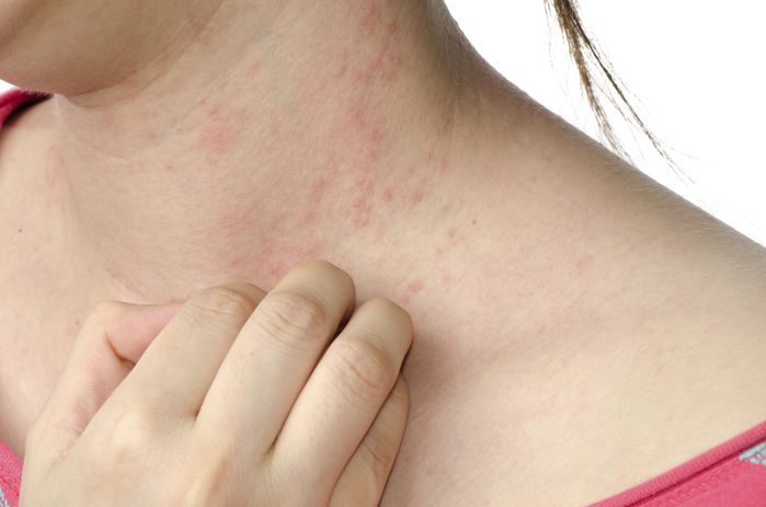 Những dấu hiệu cảnh báo bệnh nguy hiểm dễ mắc phải mà con gái thường bỏ qua Nhũng dáu hiẹu cảnh báo bẹnh nguy hiẻm dẽ mác phải mà con gái thuòng bỏ qua