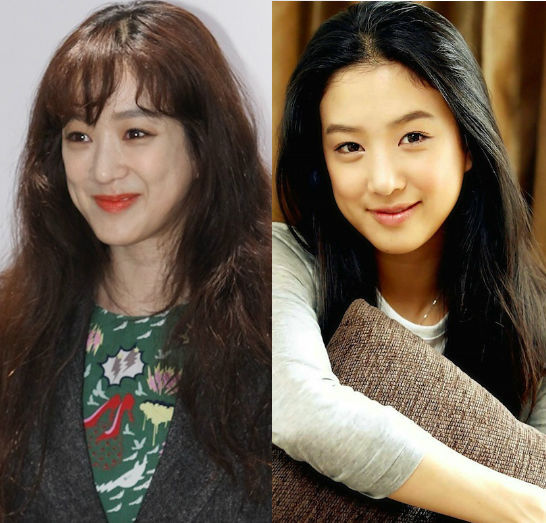 bestie sao nu Han lam dung phau thuat tham my