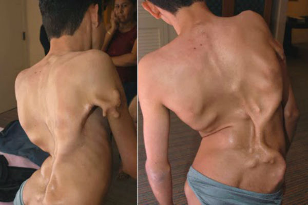 bestie nhung hoi chung ki la va kinh di nhat the gioi