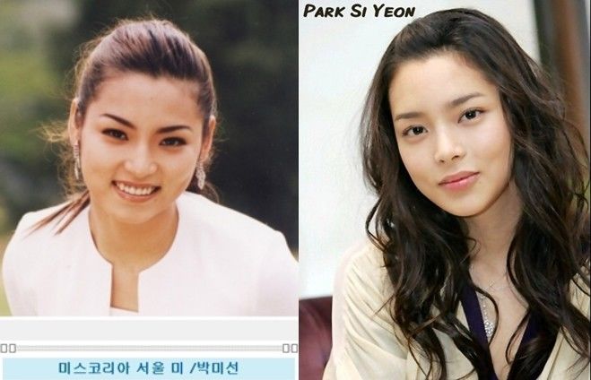 bestie sao nu Han lam dung phau thuat tham my