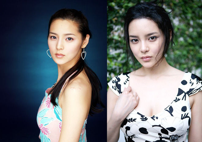 bestie sao nu Han lam dung phau thuat tham my