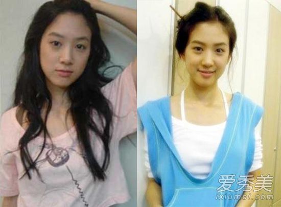 bestie sao nu Han lam dung phau thuat tham my